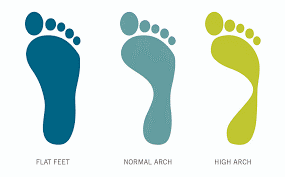 Graphic showing foot arch types: flat foot, normal arch, high arch
