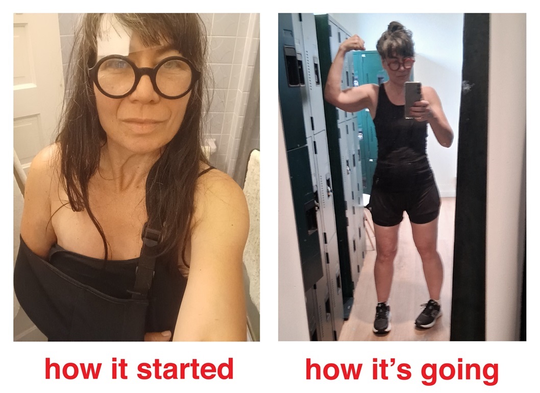 Left image: a dead-eyed woman with bandage on her forehead and left arm in a sling. Right image: the same woman, fit and flexing. Text: how it started/how it's going